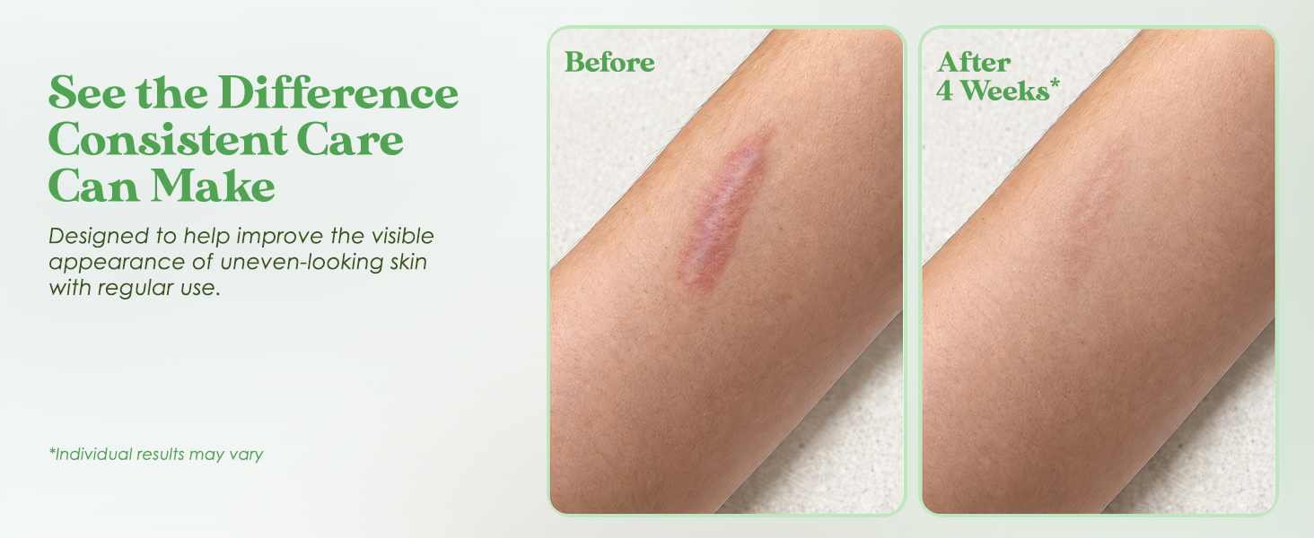 Sol Science Advanced Silicone Scar Cream