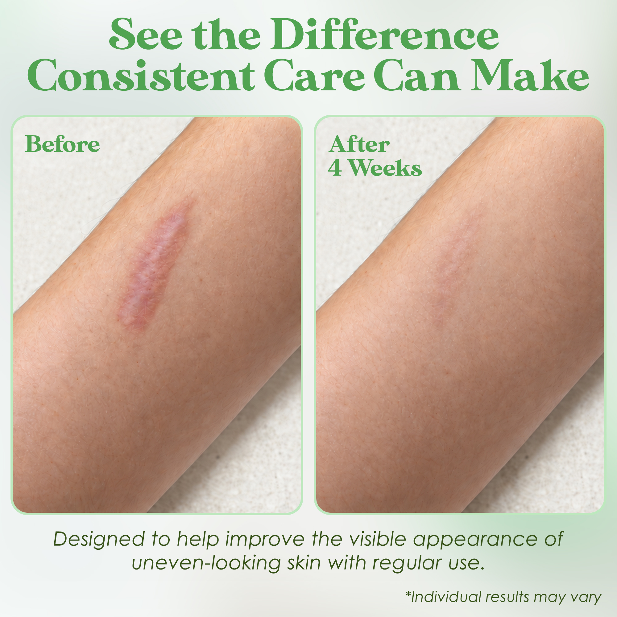 Sol Science Advanced Silicone Scar Cream